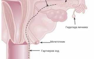 Факты о том, можно ли заниматься сексом при кисте