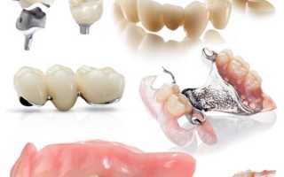 Перечень недорогих зубных протезов для решения задач любой сложности
