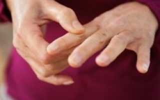 Онемение указательного пальца левой руки причины