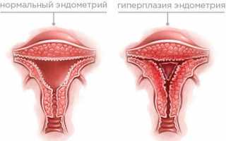 Безопасный комплекс с доказанной эффективностью «Тайм Фактор» при месячных