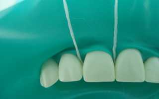 Чистка каналов зуба: этапы проведения, действия пациента