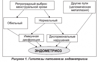 Опасный эндометриоз: выделения и другие симптомы заболевания