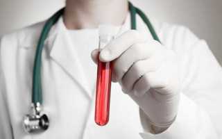 Rdv анализ крови расшифровка норма у женщин