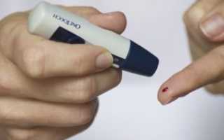 Анализ крови на инсулин — как сдавать, расшифровка показателей