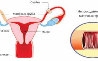 Почему возникает эндометриоз после родов