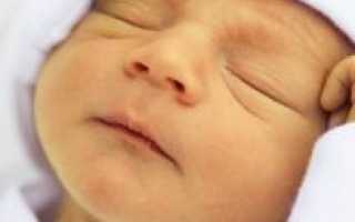 Какая норма билирубина в крови у новорожденных