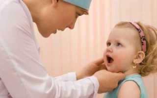Грамотный подход к терапии герпетического стоматита у маленьких детей