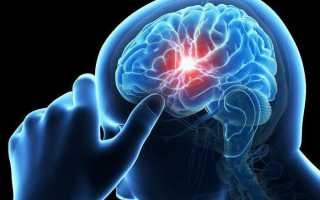 Признаки ангиоэнцефалопатии головного мозга