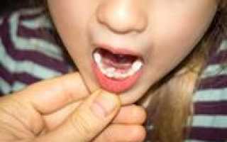 Выровнять зубы можно и в домашних условиях, а реально ли это без участия врача?