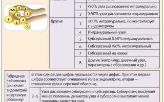Основные виды миомы матки