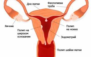 Что делать, если болит низ живота, и кровянистые выделения появились