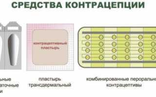 Когда и какими будут месячные после выкидыша