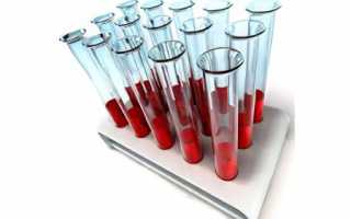 Alt анализ крови расшифровка норма у женщин