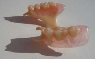 Обзор зубных протезов Acry Free (Акри фри)