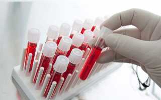 Расшифровка анализа крови на половые гормоны