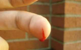 Как остановить кровь при сильном порезе пальца
