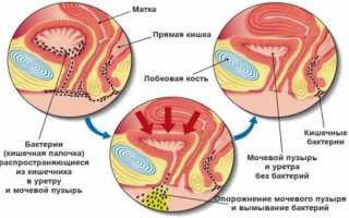 В чем кроются причины зуда перед месячными