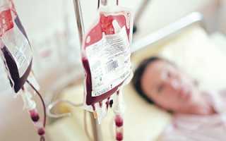 Переливание крови как называется процедура
