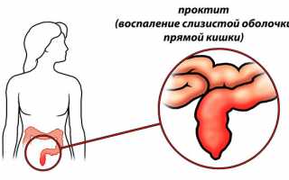 Скорые и отдаленные последствия гонореи