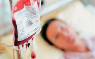 При каких заболеваниях делают переливание крови
