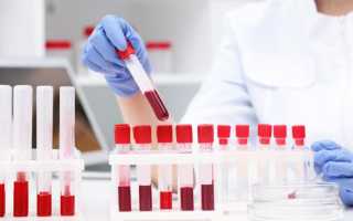 Низкий гемоглобин в крови — причины и способы повысить