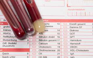 Биохимический анализ крови референсные значения