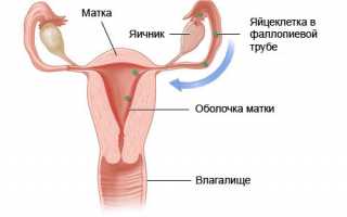 Основные причины скудных месячных и методы их лечения