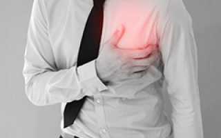 Причины развития ишемической болезни сердца