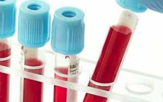 Как подготовиться к клиническому анализу крови