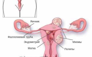 Поможет ли красная щетка при месячных, приходящих со сбоями