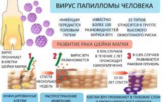 Насколько опасны остроконечные кондиломы