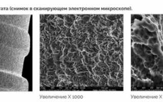 Израильские Альфа-Био имплантаты — бюджетное и надежное восстановление зубного ряда