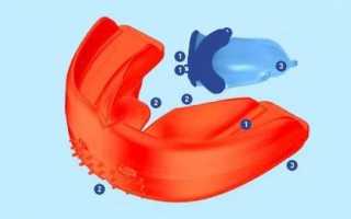 Эффективность коррекции дефектов прикуса трейнером Т4к