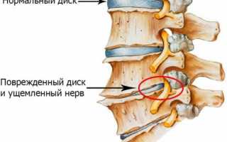 Причины, почему во время месячных болит голова, и варианты избавления от дискомфорта